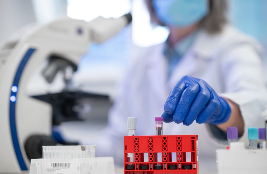 Imagem JPG, Secretaria de Saúde de Penha investe mais R$ 841 mil em exames laboratoriais com novo credenciamento